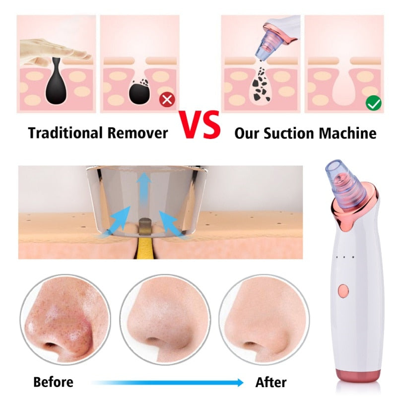 New Electric Facial Blackhead Vacuum Pore Remover Tool